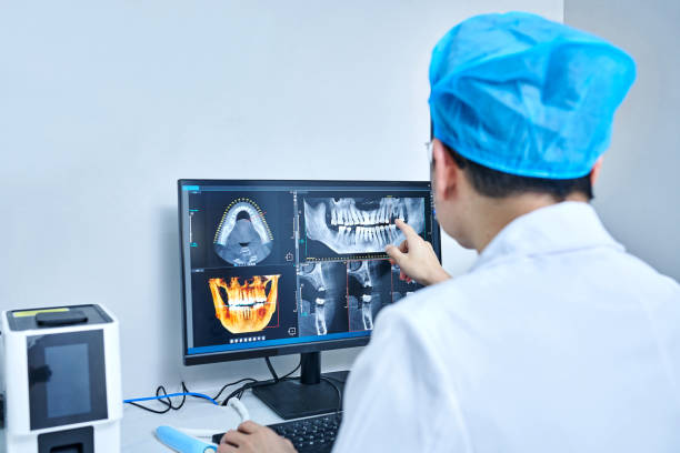 Best Emergency Wisdom Teeth Removal in New Miami, OH
